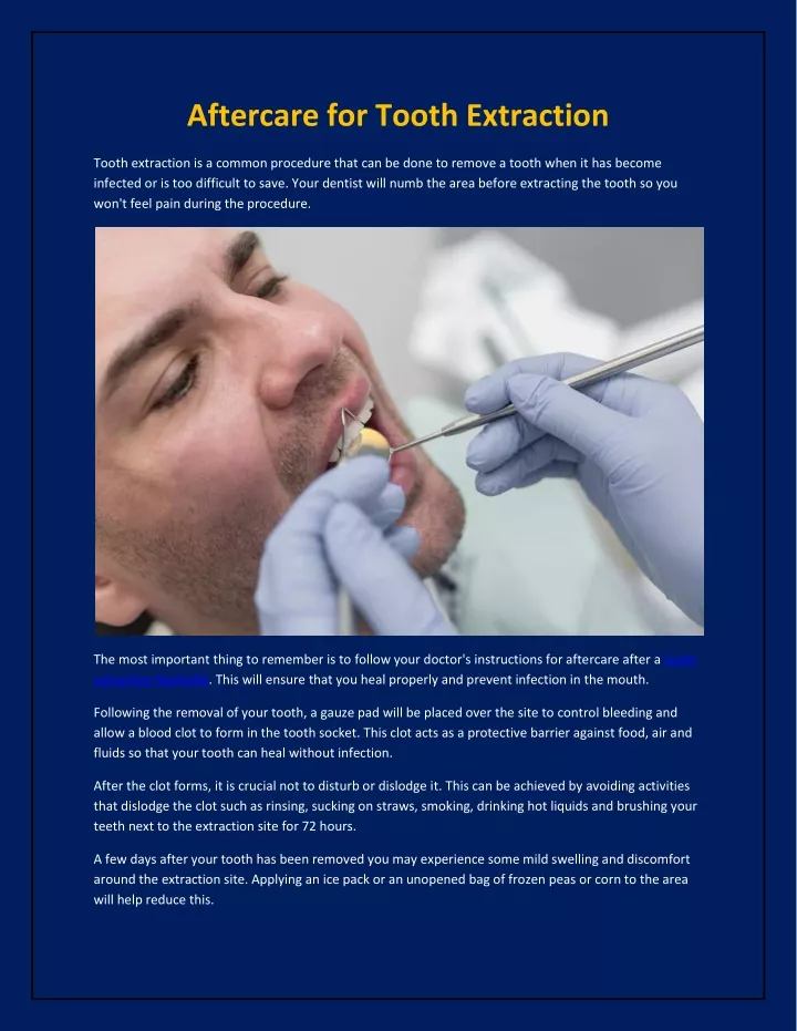 Ppt Aftercare For Tooth Extraction Powerpoint Presentation Free