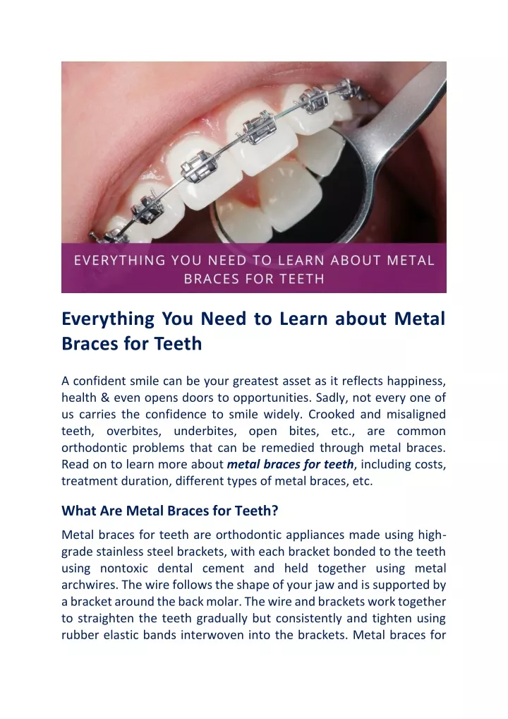 Ppt Questions You Need To Ask Before Getting Metal Braces For Teeth