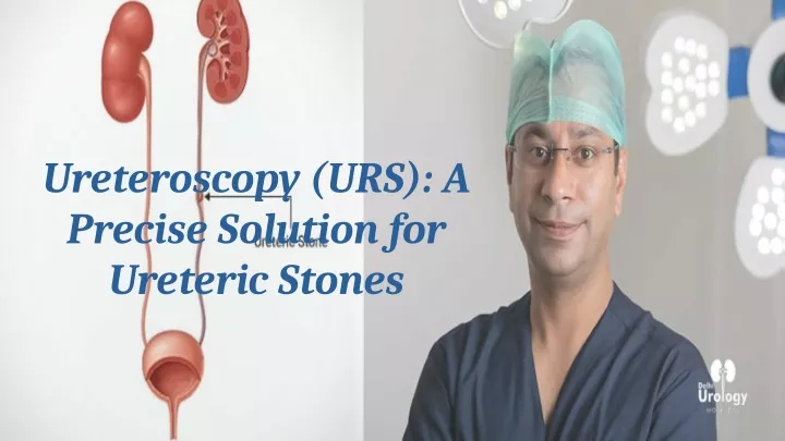 PPT Ureteroscopy URS A Precise Solution For Ureteric Stones