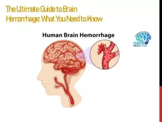 The Ultimate Guide to Brain Hemorrhage What You Need to Know