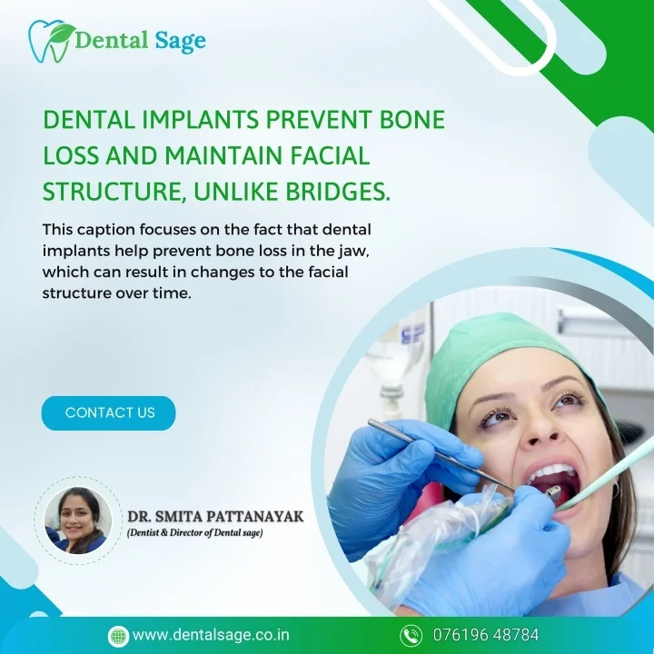 PPT Dental implants prevent bone loss Dental Clinic in Yelahanka