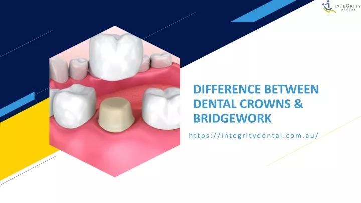difference between dental crowns bridgework