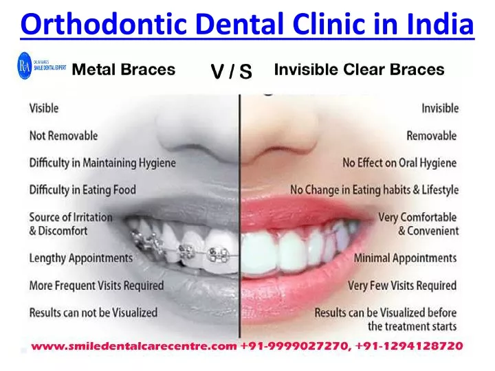 orthodontic dental clinic in india