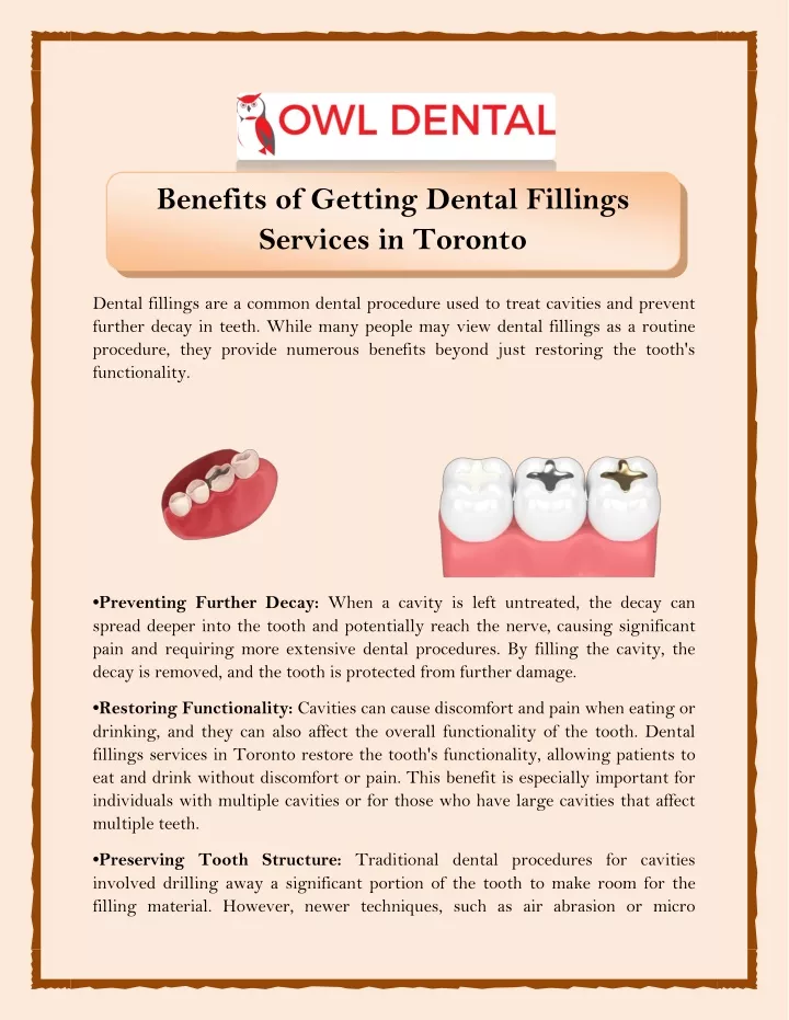 benefits of getting dental fillings services