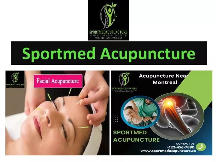 sportmed acupuncture