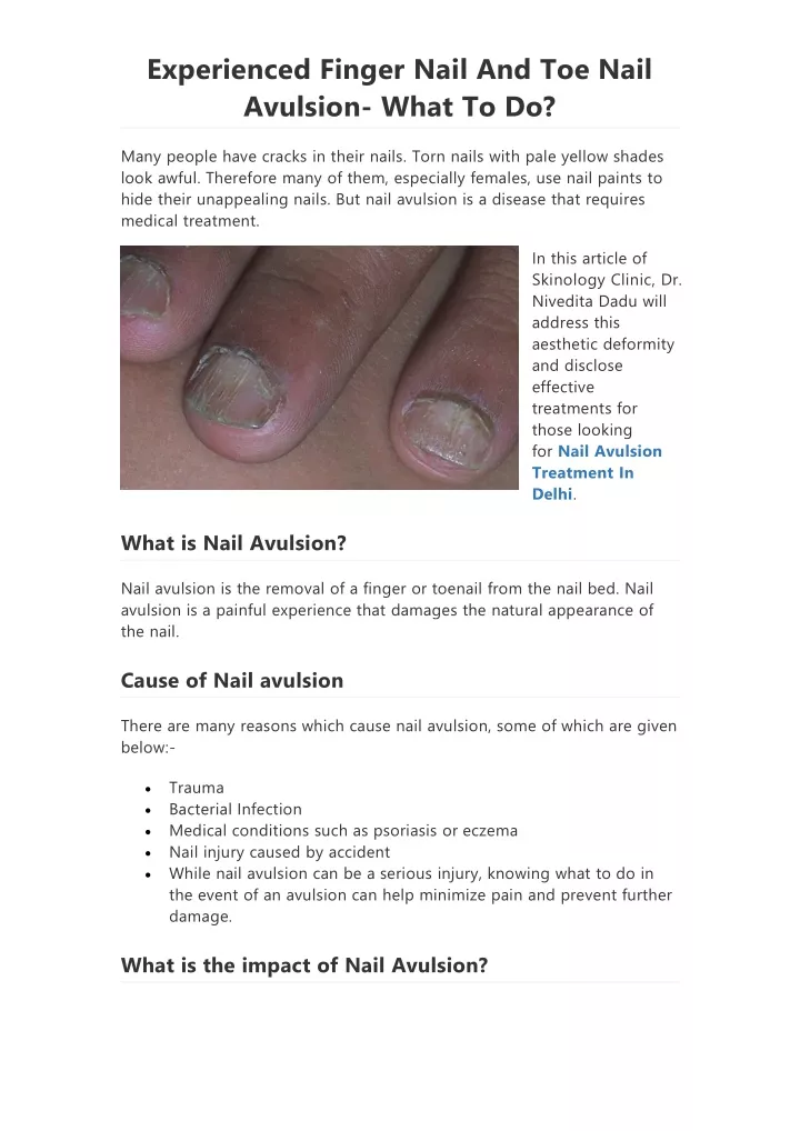 experienced finger nail and toe nail avulsion