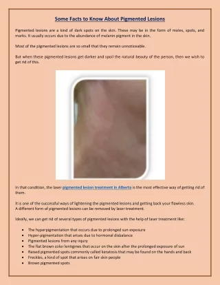 Some Facts to Know About Pigmented Lesions | Pigmented Lesions Treatment