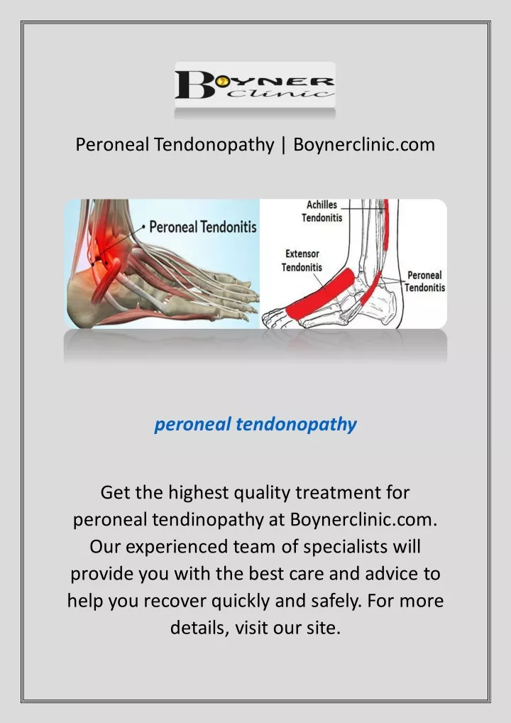 peroneal tendonopathy boynerclinic com