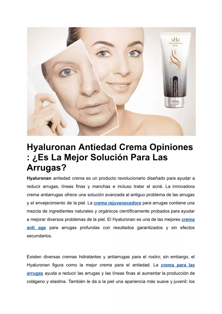 hyaluronan antiedad crema opiniones es la mejor