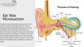 Ear Wax Microsuction