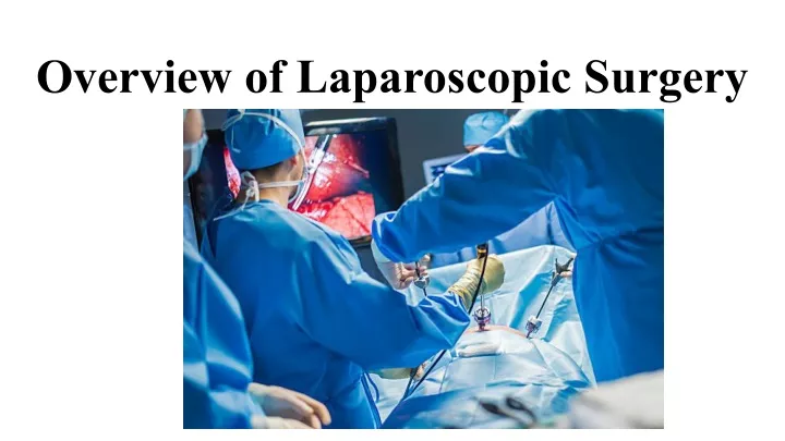 overview of laparoscopic surgery