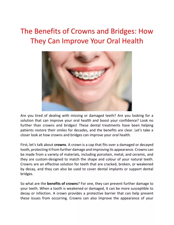 the benefits of crowns and bridges how they