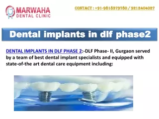 Dental implants in dlf phase2
