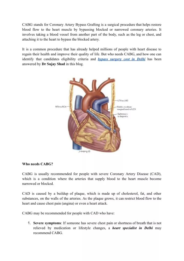 cabg stands for coronary artery bypass grafting