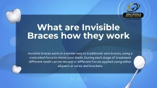 What are Invisible Braces How They Work | Smile Dental and Implant Centre