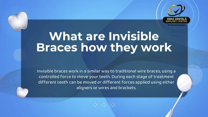 what are invisible braces how they work