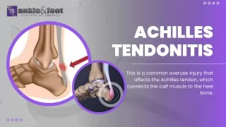 Achilles Tendonitis: Understanding the Condition, Treatment and Prevention