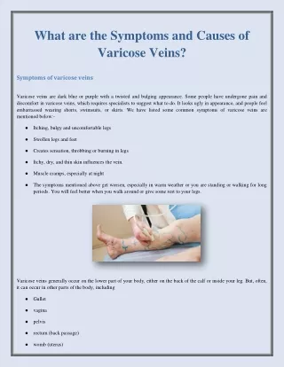 What are the Symptoms and Causes of Varicose Veins?