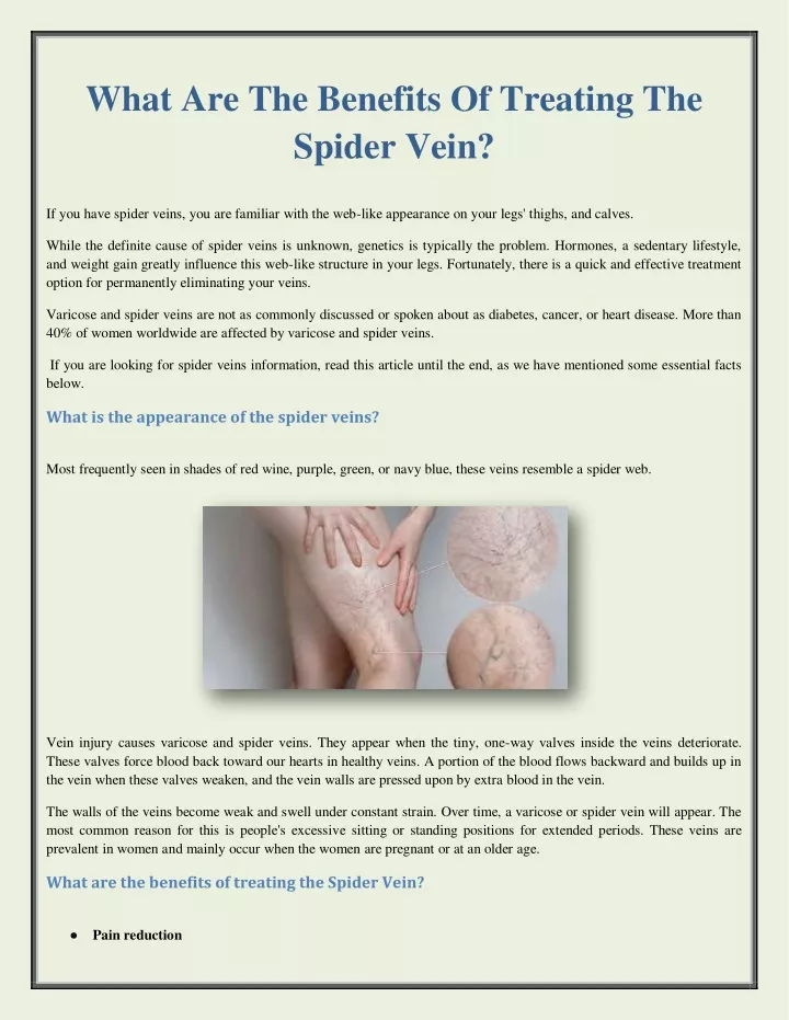 what are the benefits of treating the spider vein