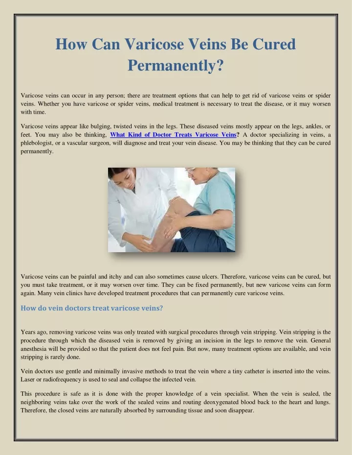 how can varicose veins be cured permanently