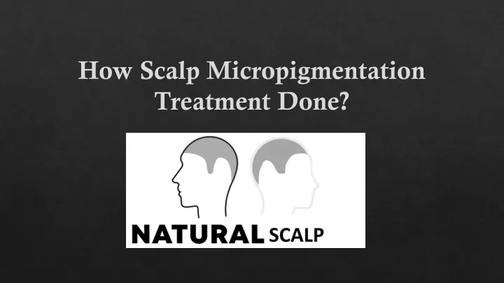 how scalp micropigmentation treatment done