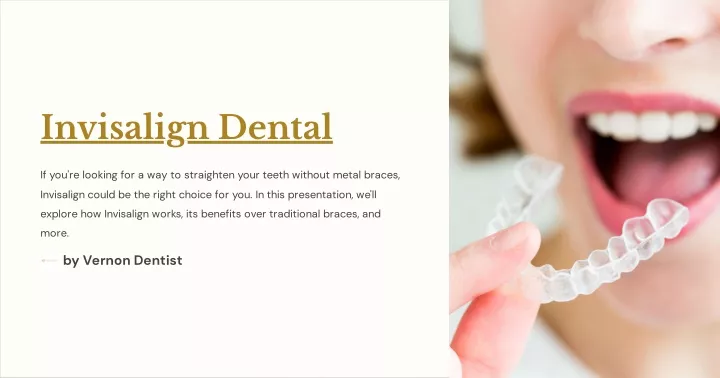 invisalign dental