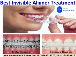 Orthodontic Oral treatments as Invisible Aligner and Dental Braces Treatment by