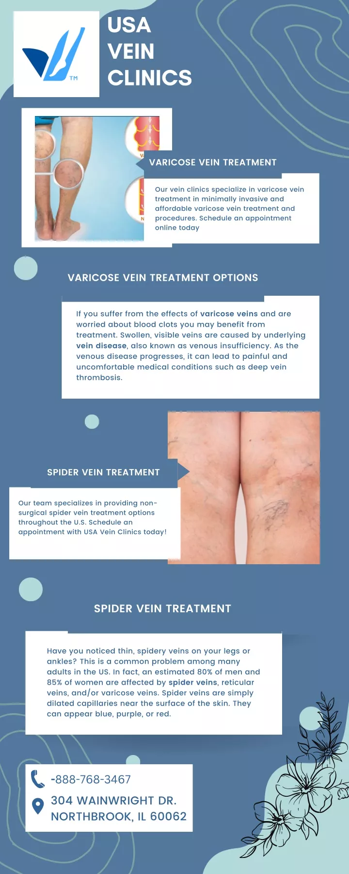 Varicose Vein Treatment And Procedures