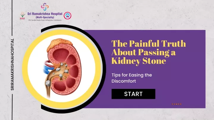the painful truth about passing a kidney stone