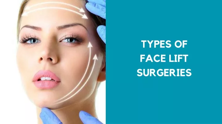 types of face lift surgeries