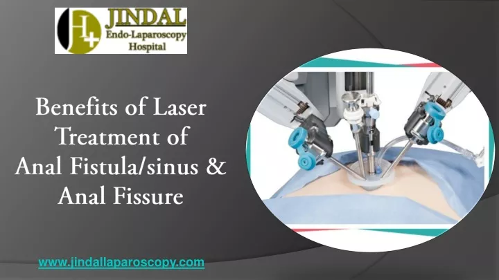 benefits of laser treatment of anal fistula sinus