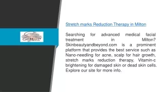 Stretch Marks Reduction Therapy in Milton Skinbeautyandbeyond.com