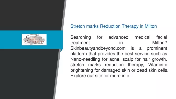 stretch marks reduction therapy in milton