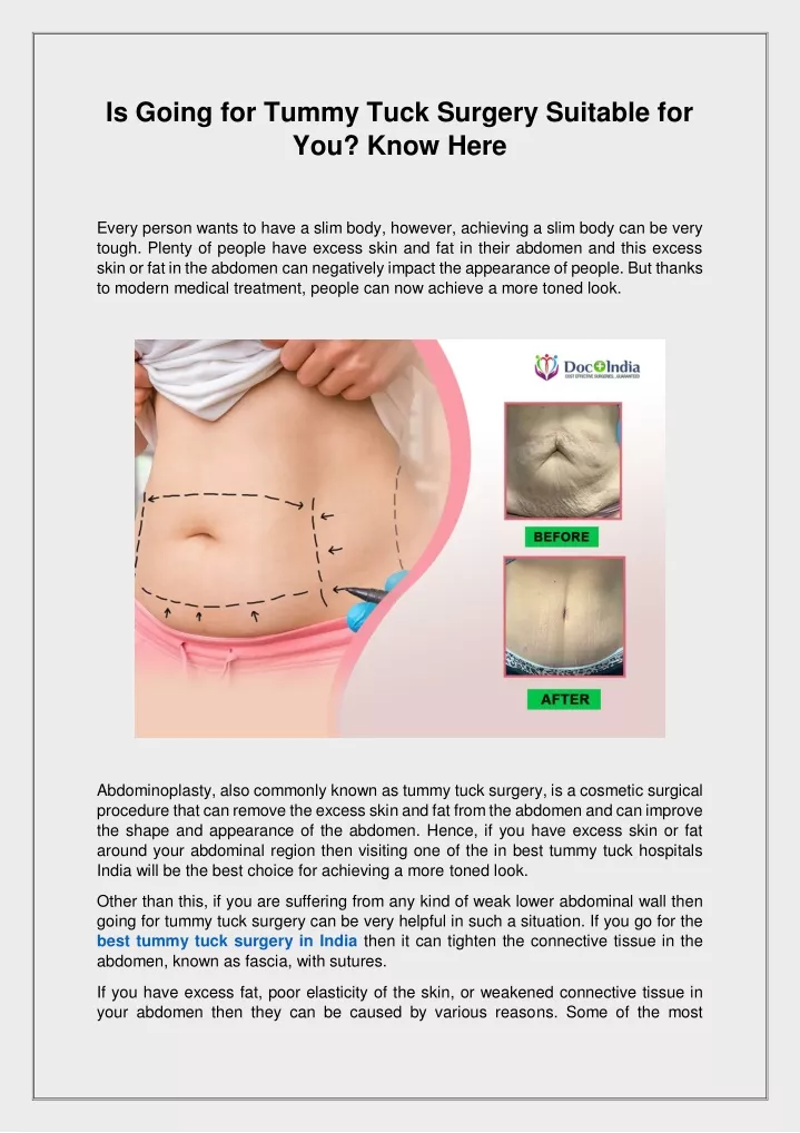 is going for tummy tuck surgery suitable