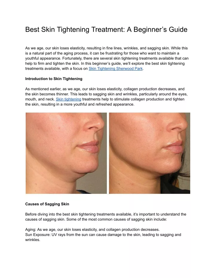 best skin tightening treatment a beginner s guide