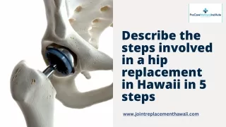 Describe the steps involved in a hip replacement in Hawaii in 5 steps