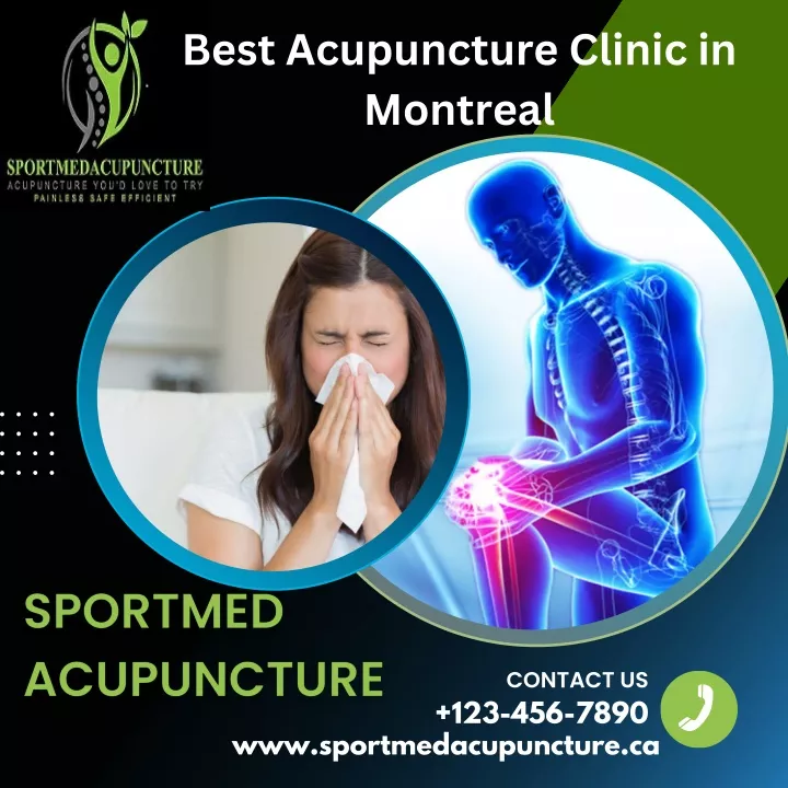 best acupuncture clinic in montreal