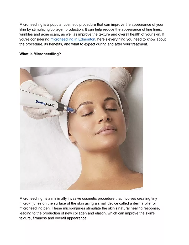 microneedling is a popular cosmetic procedure