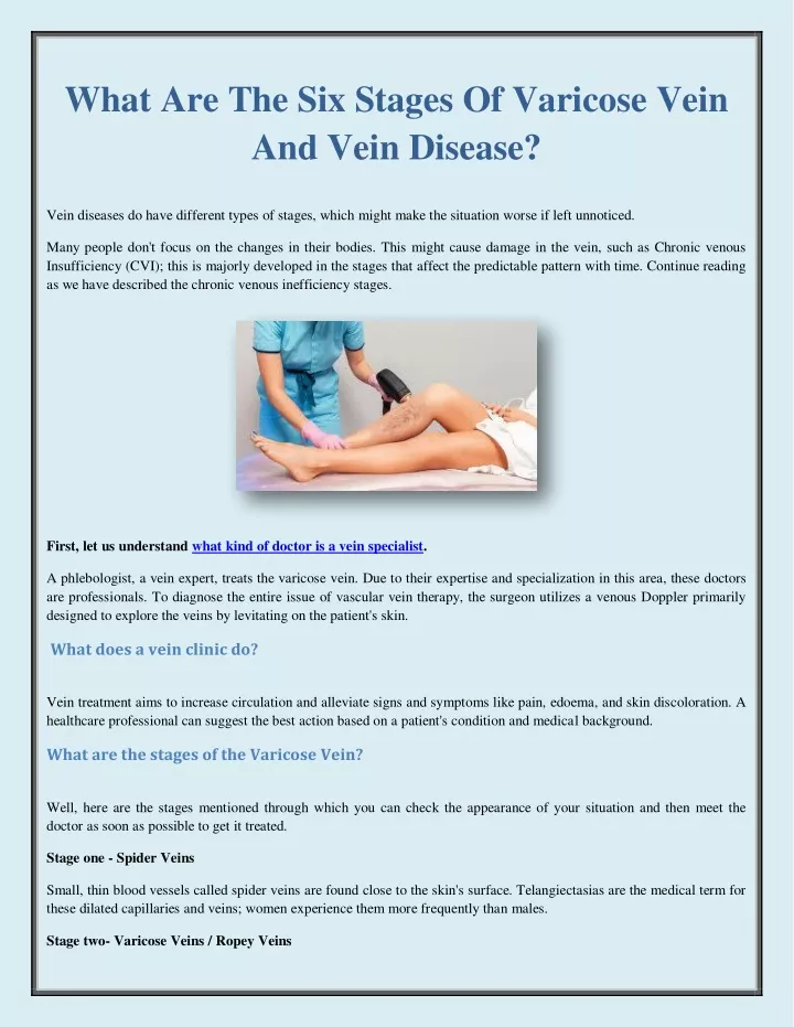 what are the six stages of varicose vein and vein