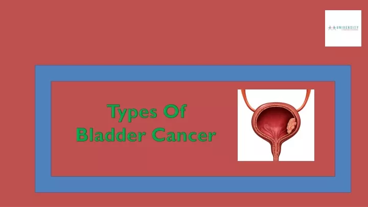 types of bladder cancer