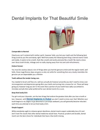 Dental Implants for That Beautiful Smile