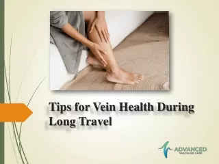 Tips for Vein Health During Long Travel