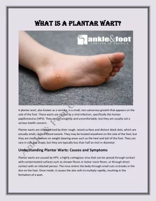 What Is a Plantar Wart