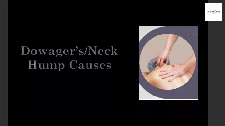 dowager s neck hump causes