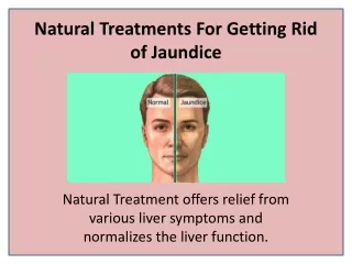 natural treatments for getting rid of jaundice