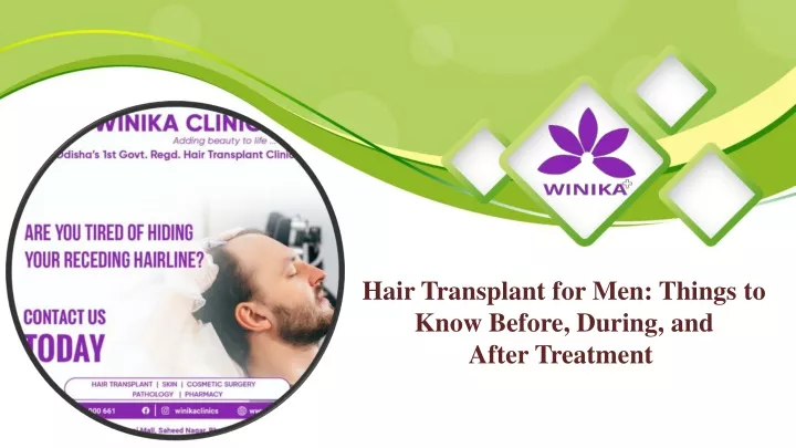 hair transplant for men things to know before