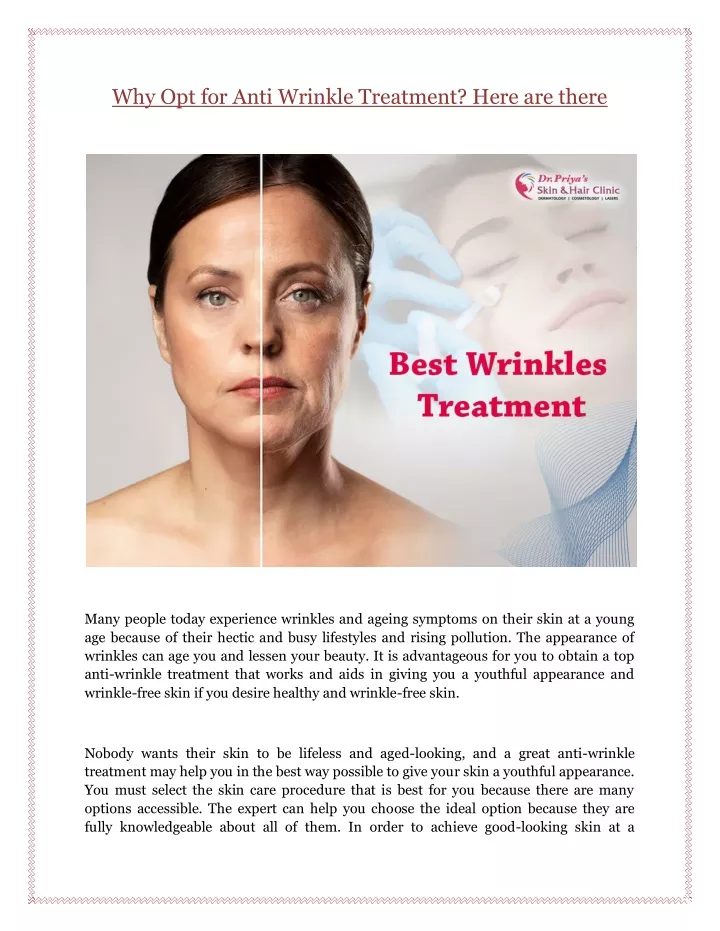 why opt for anti wrinkle treatment here are there