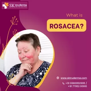 What is Rosacea | Best Skin Specialist in Sarjapur Road | Dr. Kavitha GV Mandal