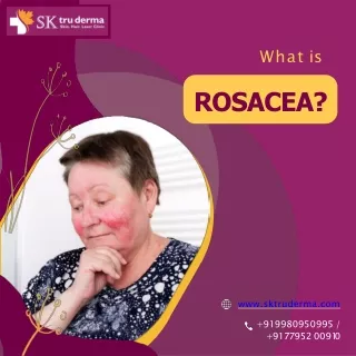 What is Rosacea | Dermatologist in sarjapur road | Dr. Kavitha GV Mandal