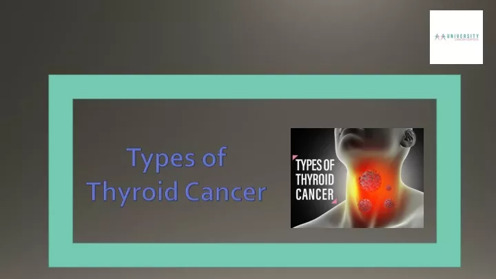 types of thyroid cancer